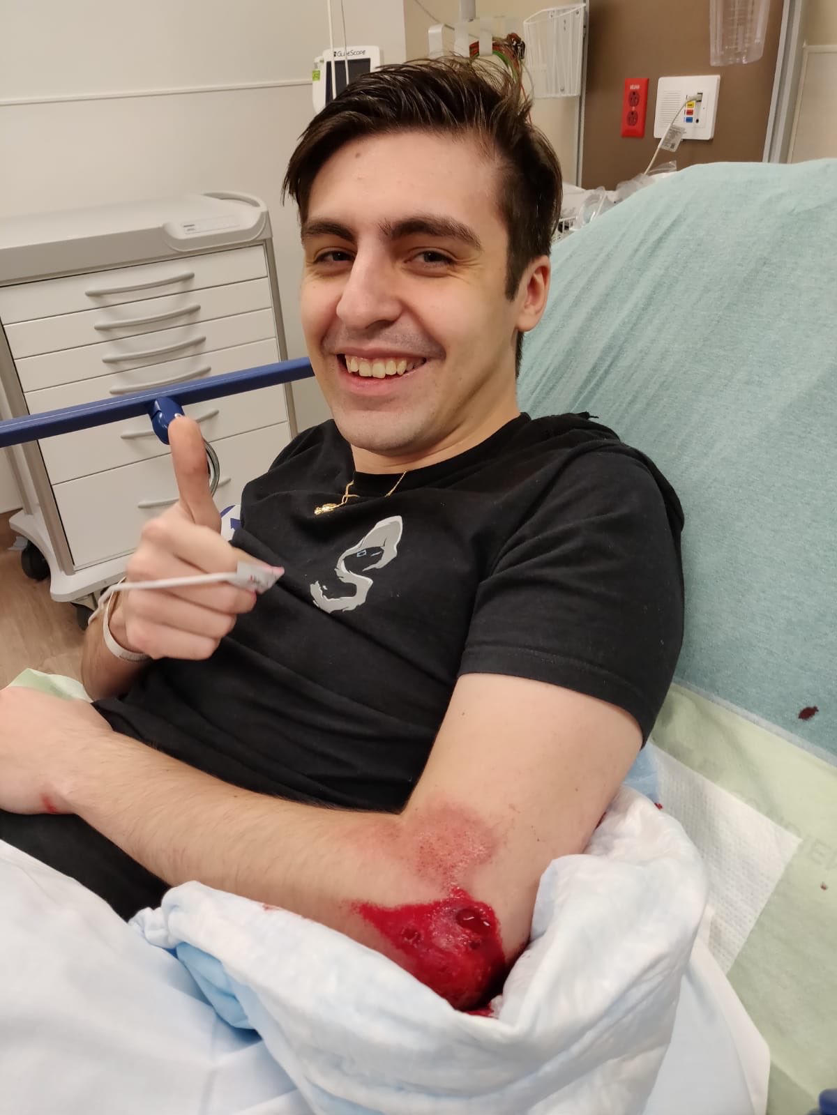 大魔王shroud手肘骨折住院或影响操作